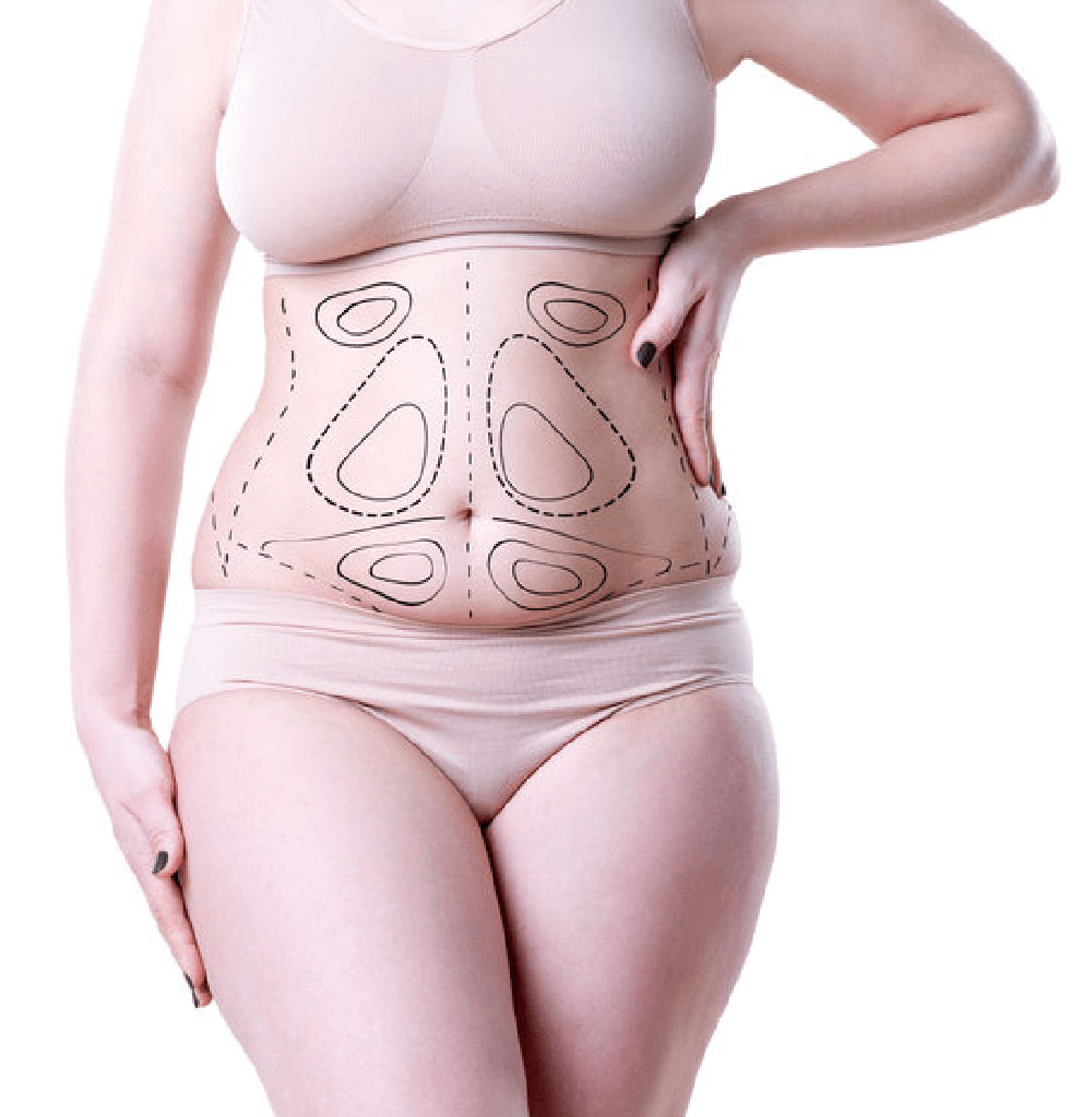 Cosmetic Surgery Lymphatic Drainage Puyallup - Tacoma